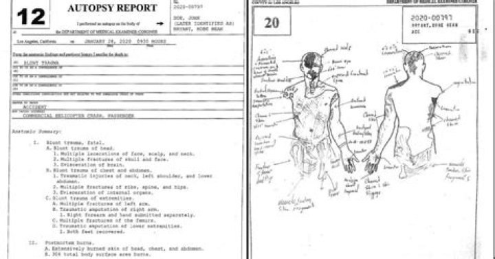 Are autopsy results public?