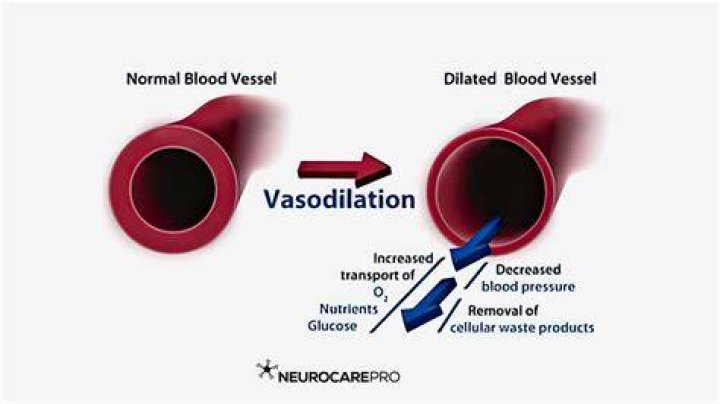 Can anxiety cause vasodilation?