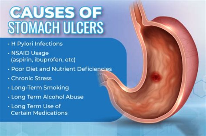Can ulcers cause spooking in horses?