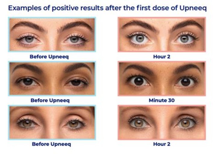 Do tired eyes make you sleepy?