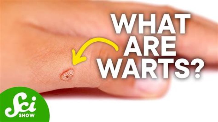 Do toads actually give you warts?