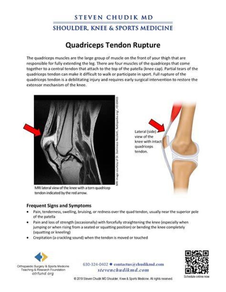 Does torn quadriceps tendon require surgery?
