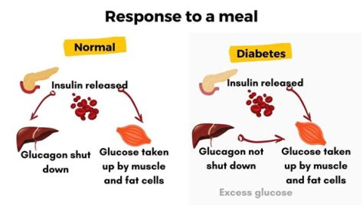 Does torsemide raise blood sugar?