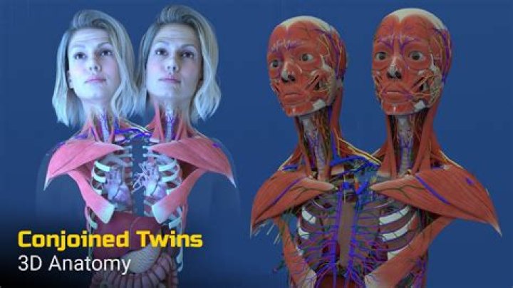 How do you name twins?