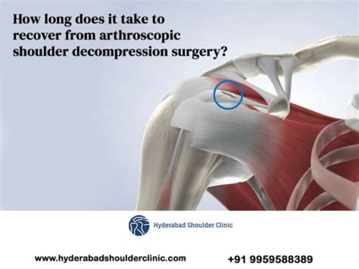 How long does pain last after keyhole surgery?