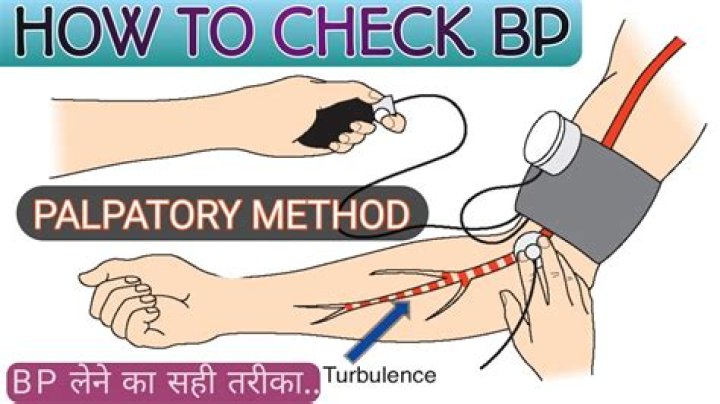 How to write palpated blood pressure?