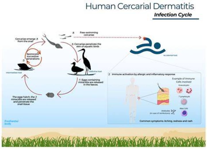Is cercarial dermatitis dangerous?