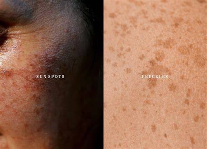 Is sunspots a fungus?