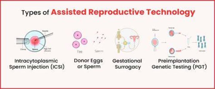 What is assisted reproductive technology?