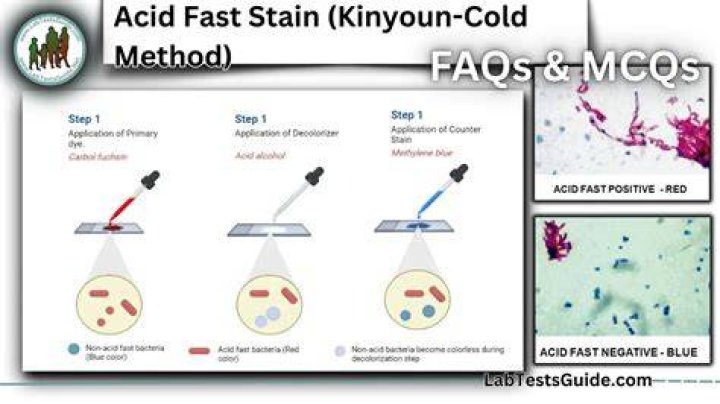 What is decolorizer in acid fast staining?