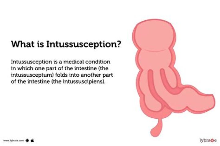 What is intussusception in biology?