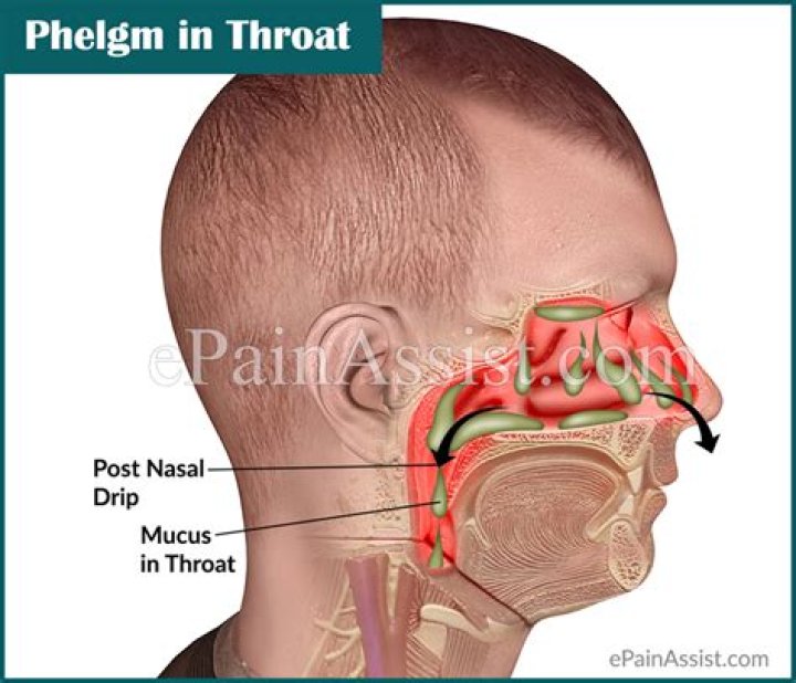 What is phlegm in throat?