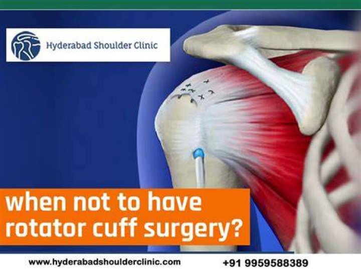 When not to have rotator cuff surgery?