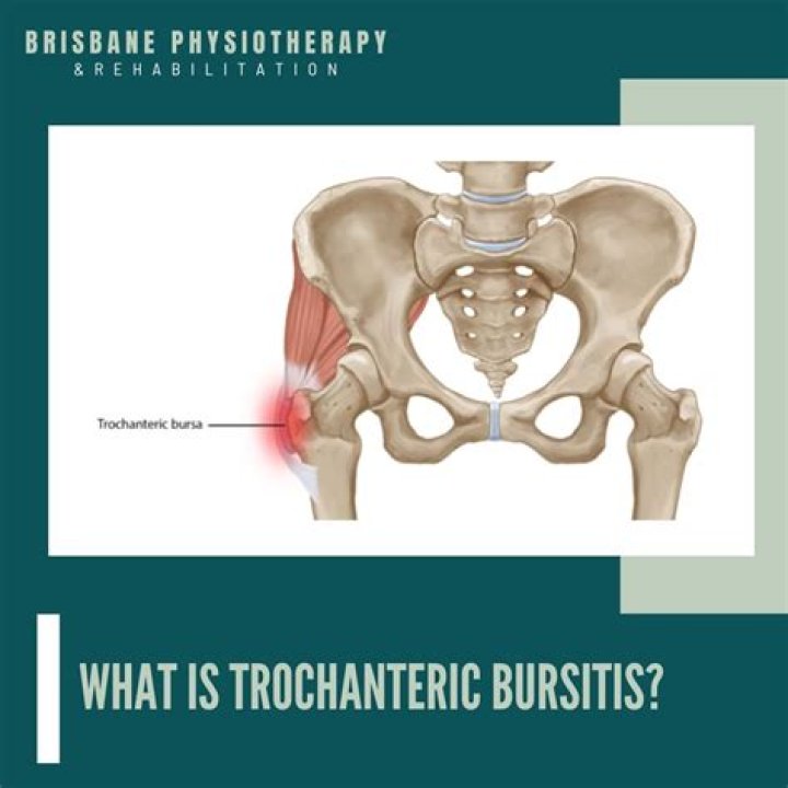 Where is trochanteric bursitis pain located?