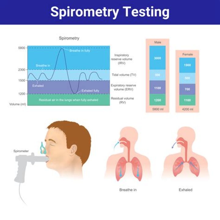 Which of the spirometry measurement?