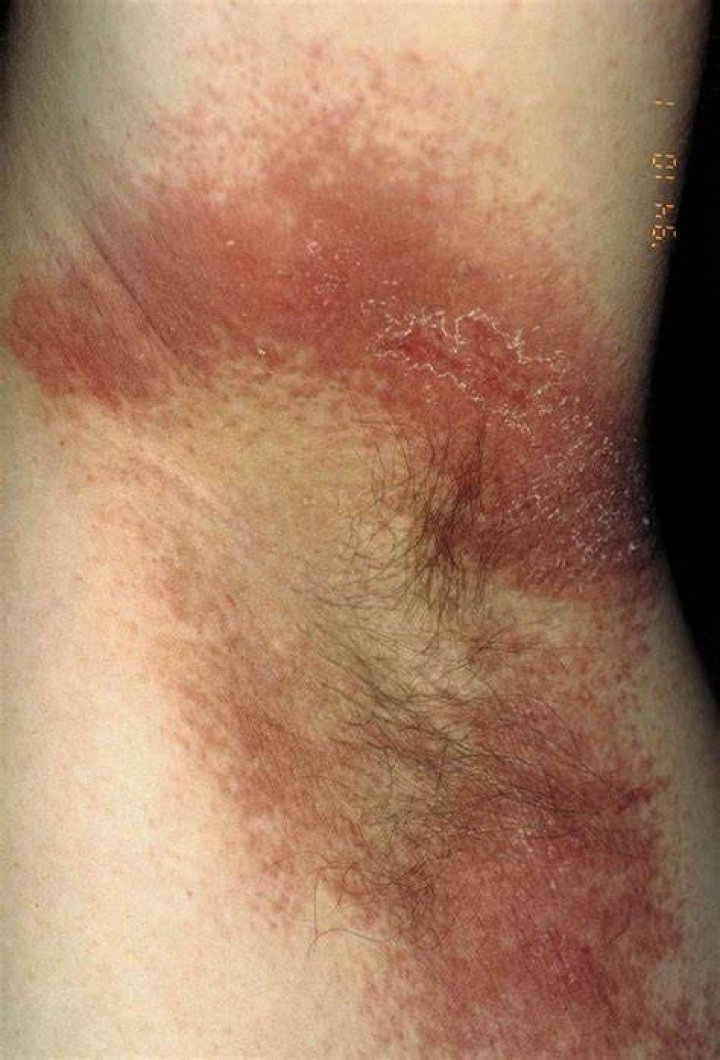 Why do my underarms hurt?
