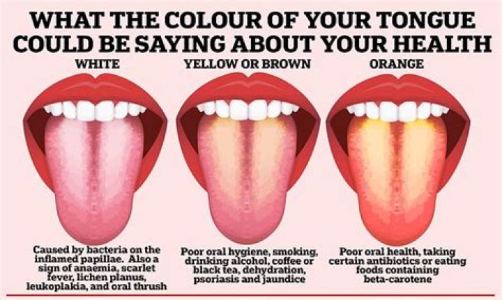 Why is my tongue always cold?